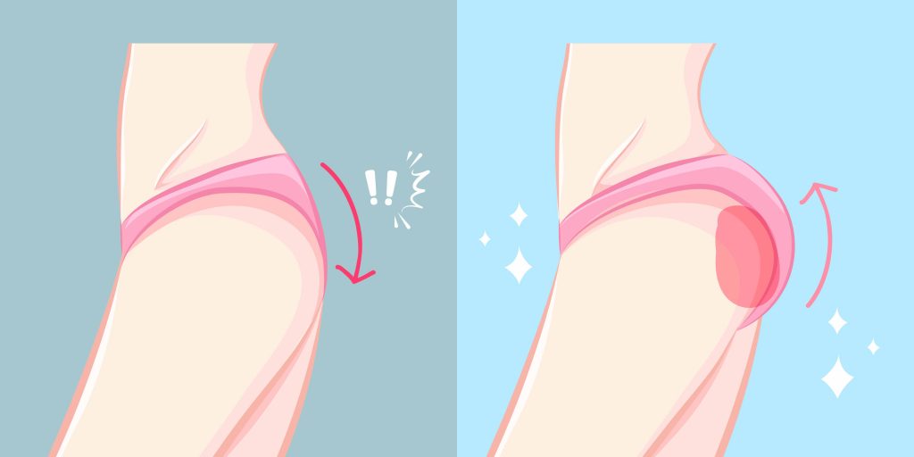 Reasons Why Butt Enhancement is So Popular